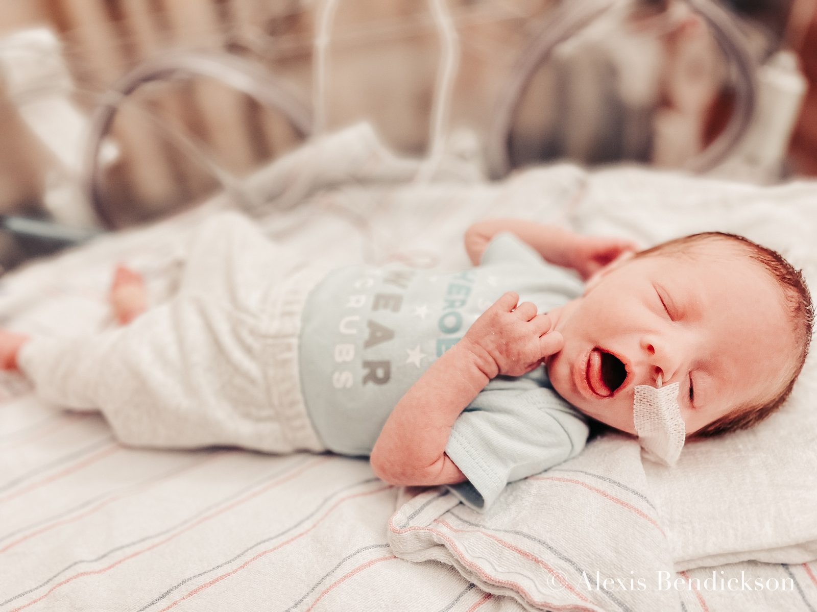 Newborn Emme yawning in the NICU, February 2022